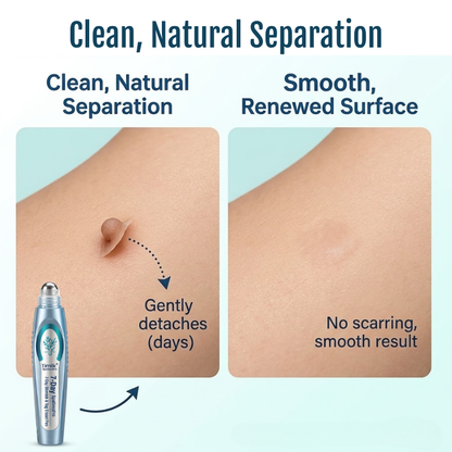 SpotlessPro® 7-Day Advanced Blemish & Tag Eraser