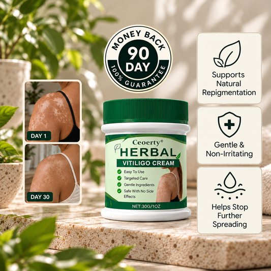 Ceoerty® Herbal Vitiligo Cream